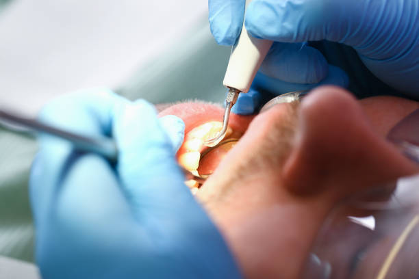 Best Tooth Infection Emergency Dentist  in Sandusky, MI