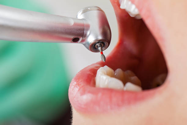 Best Emergency Gum Pain Relief  in Sandusky, MI